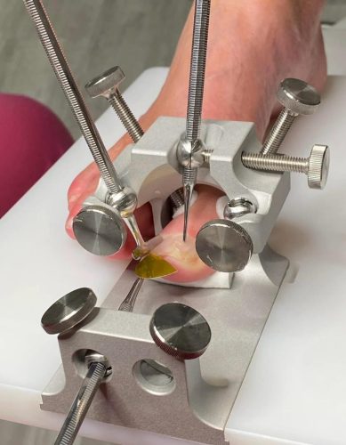 Arkada Cube (medizinisches Produkt)